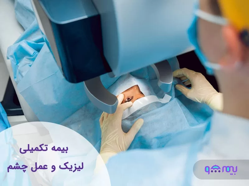سقف پرداخت بیمه تکمیلی برای لیزیک