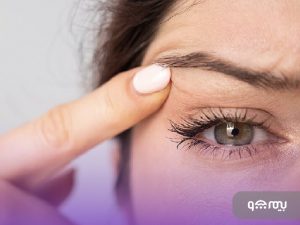 چگونه هزینه جراحی افتادگی پلک با بیمه تکمیلی را کاهش دهیم؟