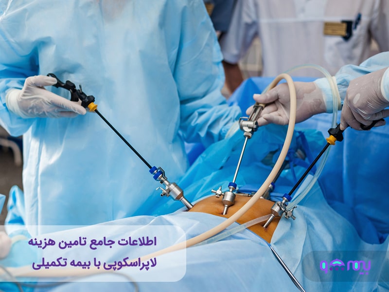 هزینه لاپراسکوپی با بیمه تکمیلی